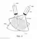 Fig. 04 - System and method for motion compensation in medical procedures