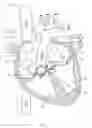 Fig. 02 - Tricuspid valve repair system