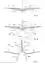 Fig. 04 - Tricuspid valve repair system