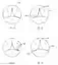 Fig. 06 - Tricuspid valve repair system
