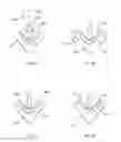 Fig. 07 - Tricuspid valve repair system
