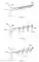 Fig. 08 - Tricuspid valve repair system