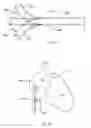 Fig. 10 - Tricuspid valve repair system