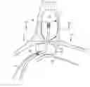 Fig. 01 - Tamponade for nasal cavities or sinus cavities