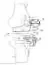Fig. 01 - Patient specific surgical guide locator and mount