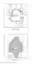 Fig. 05 - Patient specific surgical guide locator and mount