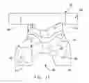 Fig. 09 - Patient specific surgical guide locator and mount