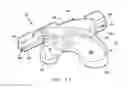 Fig. 11 - Patient specific surgical guide locator and mount