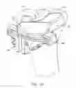 Fig. 17 - Patient specific surgical guide locator and mount
