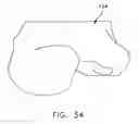 Fig. 29 - Patient specific surgical guide locator and mount