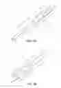 Fig. 02 - Ankle replacement system and method