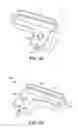 Fig. 03 - Ankle replacement system and method