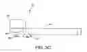 Fig. 06 - Ankle replacement system and method