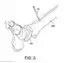 Fig. 08 - Ankle replacement system and method