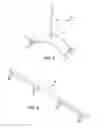 Fig. 10 - Ankle replacement system and method