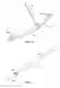 Fig. 11 - Ankle replacement system and method