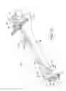 Fig. 12 - Ankle replacement system and method