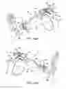 Fig. 13 - Ankle replacement system and method