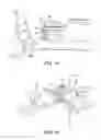 Fig. 15 - Ankle replacement system and method