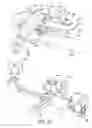Fig. 19 - Ankle replacement system and method