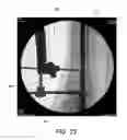 Fig. 20 - Ankle replacement system and method