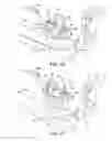 Fig. 22 - Ankle replacement system and method