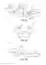 Fig. 26 - Ankle replacement system and method