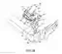 Fig. 31 - Ankle replacement system and method