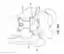 Fig. 33 - Ankle replacement system and method