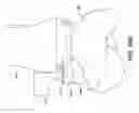 Fig. 34 - Ankle replacement system and method