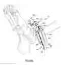 Fig. 47 - Ankle replacement system and method