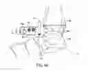 Fig. 51 - Ankle replacement system and method