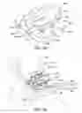 Fig. 57 - Ankle replacement system and method