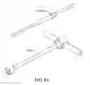 Fig. 58 - Ankle replacement system and method