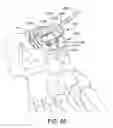 Fig. 62 - Ankle replacement system and method