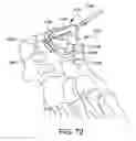 Fig. 67 - Ankle replacement system and method