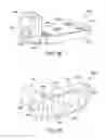 Fig. 72 - Ankle replacement system and method