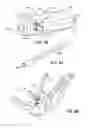 Fig. 74 - Ankle replacement system and method