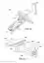 Fig. 76 - Ankle replacement system and method
