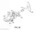 Fig. 77 - Ankle replacement system and method