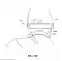 Fig. 83 - Ankle replacement system and method