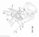 Fig. 84 - Ankle replacement system and method