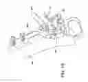 Fig. 85 - Ankle replacement system and method