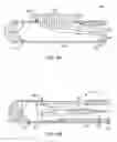 Fig. 05 - Tissue cutting device and system