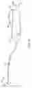 Fig. 10 - Tissue cutting device and system