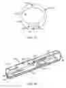 Fig. 11 - Tissue cutting device and system