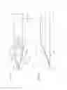 Fig. 03 - Medical puncture needle and method for manufacturing puncture needle