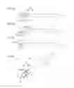 Fig. 06 - Medical puncture needle and method for manufacturing puncture needle