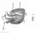 Fig. 02 - Devices, systems, and methods for delivering a substance within a mammalian luminal organ or area adjacent thereto