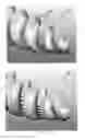 Fig. 06 - Spinal fastener with serrated thread